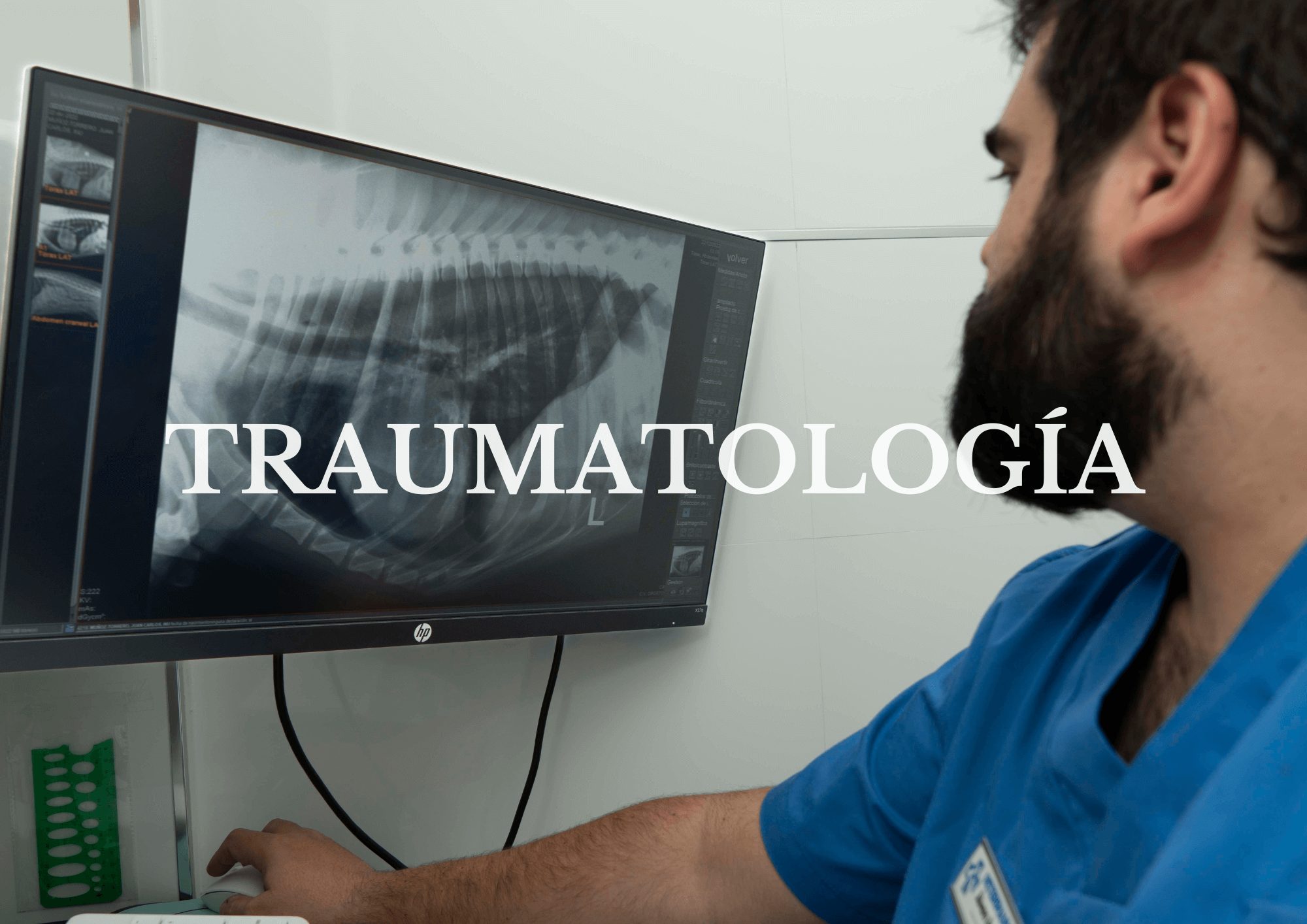 Traumatología Traumatología